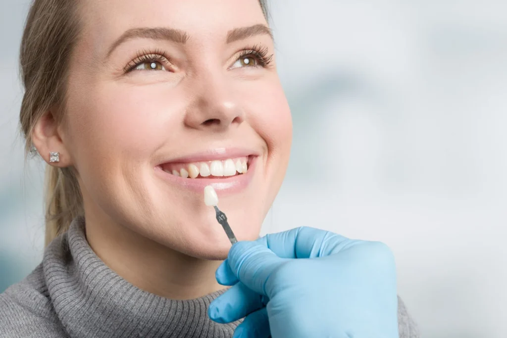 How Veneers Work