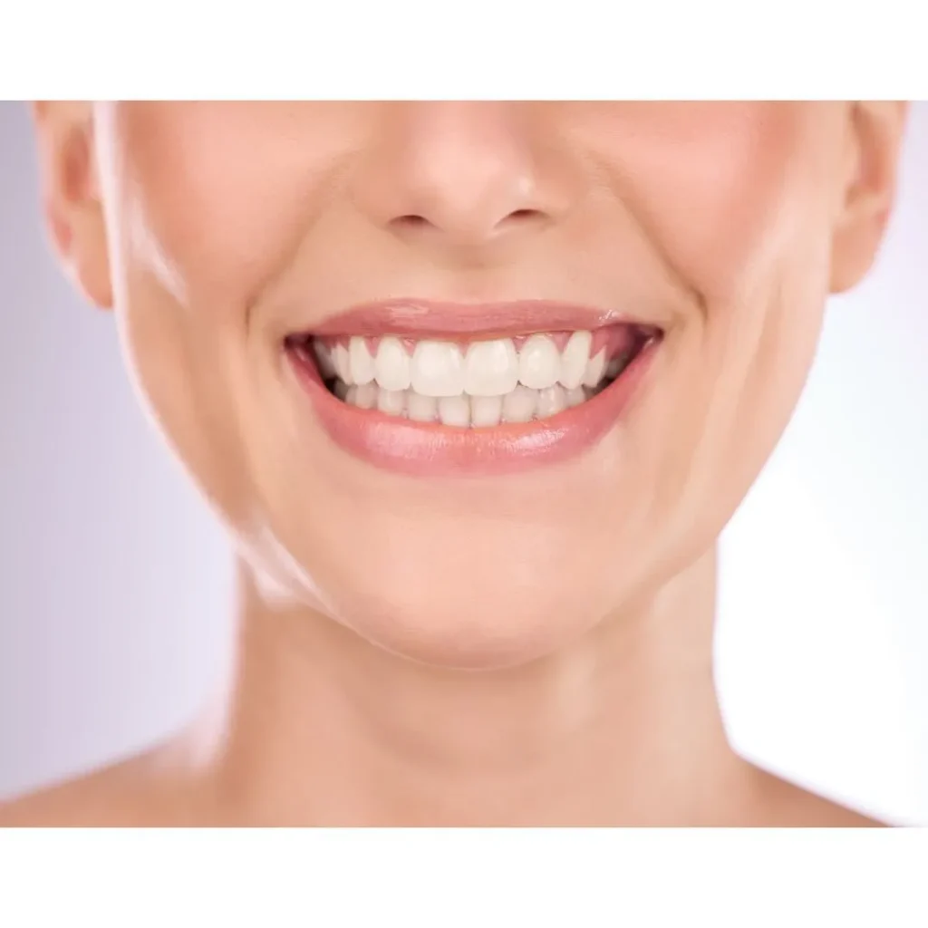 Professional Teeth Whitening